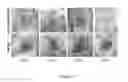 Fig. 44 - COMPOSITIONS AND METHODS FOR WOUND HEALING, AND FOR RECRUITMENT AND ACTIVATION OF MACROPHAGES IN INJURED TISSUES AND IN IMPLANTED BIOMATERIALS USED FOR TISSUE ENGINEERING