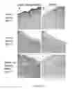 Fig. 45 - COMPOSITIONS AND METHODS FOR WOUND HEALING, AND FOR RECRUITMENT AND ACTIVATION OF MACROPHAGES IN INJURED TISSUES AND IN IMPLANTED BIOMATERIALS USED FOR TISSUE ENGINEERING