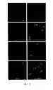 Fig. 07 - MICROVESICLES ISOLATED FROM MESENCHYMAL STEM CELLS FOR USE AS IMMUNOSUPPRESSIVE AGENTS