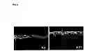Fig. 07 - ECTOCORNEA-LIKE SHEET AND METHOD OF CONSTRUCTING THE SAME