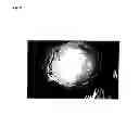 Fig. 09 - ECTOCORNEA-LIKE SHEET AND METHOD OF CONSTRUCTING THE SAME