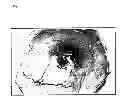 Fig. 10 - ECTOCORNEA-LIKE SHEET AND METHOD OF CONSTRUCTING THE SAME