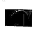 Fig. 13 - ECTOCORNEA-LIKE SHEET AND METHOD OF CONSTRUCTING THE SAME