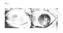Fig. 15 - ECTOCORNEA-LIKE SHEET AND METHOD OF CONSTRUCTING THE SAME
