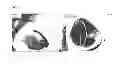 Fig. 16 - ECTOCORNEA-LIKE SHEET AND METHOD OF CONSTRUCTING THE SAME