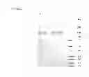 Fig. 48 - Truncated HIV envelope proteins (ENV), methods and compositions related thereto