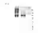 Fig. 49 - Truncated HIV envelope proteins (ENV), methods and compositions related thereto