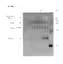 Fig. 87 - Truncated HIV envelope proteins (ENV), methods and compositions related thereto