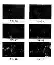 Fig. 05 - NOVEL COCHLEATE FORMULATIONS
