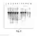 Fig. 04 - Method and medicament for inhibiting the expression of a given gene