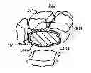 Fig. 01 - COMBINATION TABLET WITH CHEWABLE OUTER LAYER