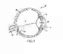 Fig. 02 - Method for stimulating retinal response using photoactive devices