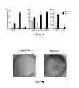Fig. 08 - METHOD OF TREATING PATHOLOGIC HETEROTOPIC OSSIFICATION