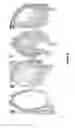 Fig. 07 - Method of promoting mucosal reciliation