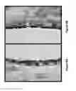 Fig. 09 - Method of promoting mucosal reciliation