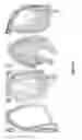 Fig. 07 - Method of debriding tissue