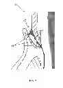 Fig. 08 - PERIODONTAL TREATMENT SYSTEM AND METHOD