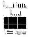 Fig. 10 - Method for screening an agent preventing or treating cancer using glycyl-tRNA synthetase and cadherin