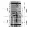 Fig. 03 - Cancer phospholipidome