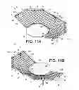 Fig. 09 - Rebound device