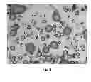 Fig. 07 - HERBICIDAL COMPOSITION COMPRISING POLYMERIC MICROPARTICLES CONTAINING A HERBICIDE