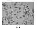 Fig. 08 - HERBICIDAL COMPOSITION COMPRISING POLYMERIC MICROPARTICLES CONTAINING A HERBICIDE