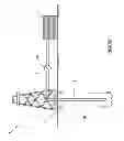 Fig. 02 - Well treatment fluids and methods utilizing nano-particles