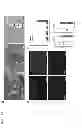 Fig. 07 - Compositions and Methods for Treating Skeletal Myopathy