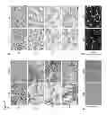 Fig. 08 - Compositions and Methods for Treating Skeletal Myopathy