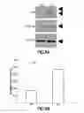 Fig. 07 - Method of Diagnosis or Prognosis of a Neoplasm Comprising Determining the Level of Expression of a Protein in Stromal Cells Adjacent to the Neoplasm