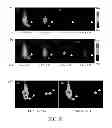 Fig. 09 - RADIOLABELED NUCLEOSIDE ANALOGUE, AND PREPARATION METHOD AND USE THEREOF