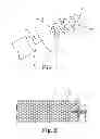 Fig. 02 - Implants, tools, and methods for treatments of pelvic conditions