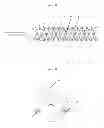 Fig. 08 - Mapping sympathetic nerve distribution for renal ablation and catheters for same