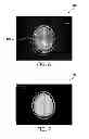 Fig. 06 - Magnetic resonance imaging of bone tissue