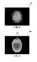 Fig. 07 - Magnetic resonance imaging of bone tissue