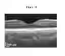 Fig. 10 - ENHANCED OPTICAL ANGIOGRAPHY USING INTENSITY CONTRAST AND PHASE CONTRAST IMAGING METHODS