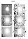 Fig. 12 - ENHANCED OPTICAL ANGIOGRAPHY USING INTENSITY CONTRAST AND PHASE CONTRAST IMAGING METHODS
