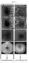 Fig. 15 - ENHANCED OPTICAL ANGIOGRAPHY USING INTENSITY CONTRAST AND PHASE CONTRAST IMAGING METHODS