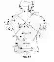 Fig. 07 - WEARABLE APPARATUS TO DETECT PULSE TRANSIT TIME