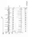 Fig. 18 - WEARABLE APPARATUS TO DETECT SLEEP STAGE INFORMATION OF AN INDIVIDUAL