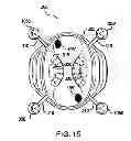 Fig. 36 - WEARABLE APPARATUS TO DETECT SLEEP STAGE INFORMATION OF AN INDIVIDUAL