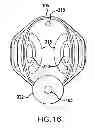 Fig. 37 - WEARABLE APPARATUS TO DETECT SLEEP STAGE INFORMATION OF AN INDIVIDUAL
