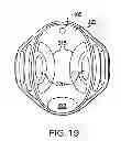 Fig. 40 - WEARABLE APPARATUS TO DETECT SLEEP STAGE INFORMATION OF AN INDIVIDUAL