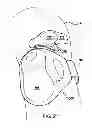 Fig. 42 - WEARABLE APPARATUS TO DETECT SLEEP STAGE INFORMATION OF AN INDIVIDUAL