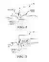 Fig. 03 - Adaptive waveform appraisal in an implantable cardiac system