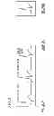 Fig. 04 - Electrocardiogram analyzer
