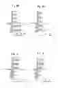 Fig. 06 - Method of detecting neurological disease