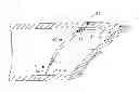 Fig. 01 - BIOPSY NEEDLE SYSTEM AND METHOD FOR OBTAINING A TISSUE BIOPSY SPECIMEN