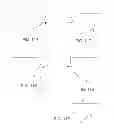Fig. 06 - BIOPSY NEEDLE SYSTEM AND METHOD FOR OBTAINING A TISSUE BIOPSY SPECIMEN