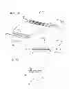 Fig. 09 - BIOPSY NEEDLE SYSTEM AND METHOD FOR OBTAINING A TISSUE BIOPSY SPECIMEN